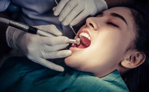 中山區植牙推薦