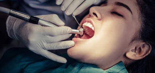 中山區植牙推薦